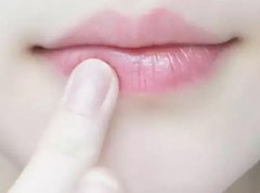 嘴唇干裂，千万不要“舔”！