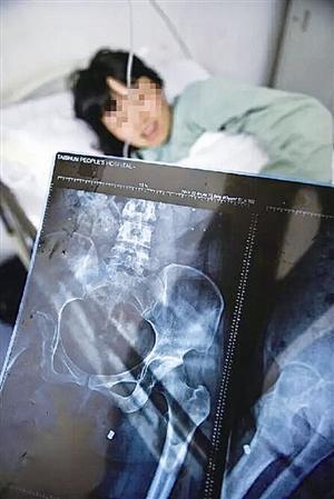 女子在娘家阳台上遭枪击屁股中弹深20厘米(图)