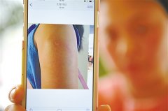 <b>重庆：7岁女童游泰国拒绝男导游亲吻被咬伤</b>