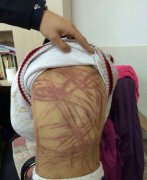 <b>南京虐童养母被刑拘 老师曾多次发现男童被打</b>