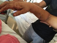 <b>辽宁：一高三班长遭老师毒打 疑因未组织同学送礼</b>