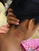 <b>广西“女子赴宴遭官员猥亵施暴”事件涉事者被严处</b>