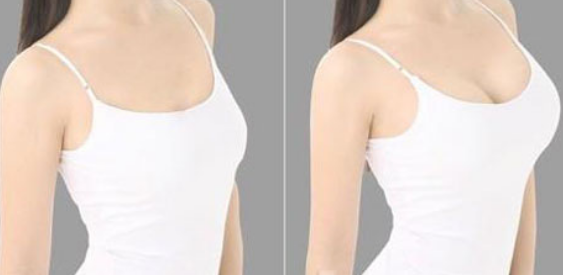 美女逗蛇被咬蛇死亡，蛇为鉴定假胸而硅胶中毒死亡(内附视频)