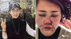 云南丽江“女子遭暴打” 景区毁了我婚姻