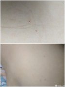 <b>甘肃一幼儿园被曝针扎孩子 警方疑让园方拿钱摆平</b>