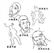 如何识别脑卒中？