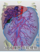 15岁男孩大肚子脾占腹腔一大半 手术切除5公斤脾脏